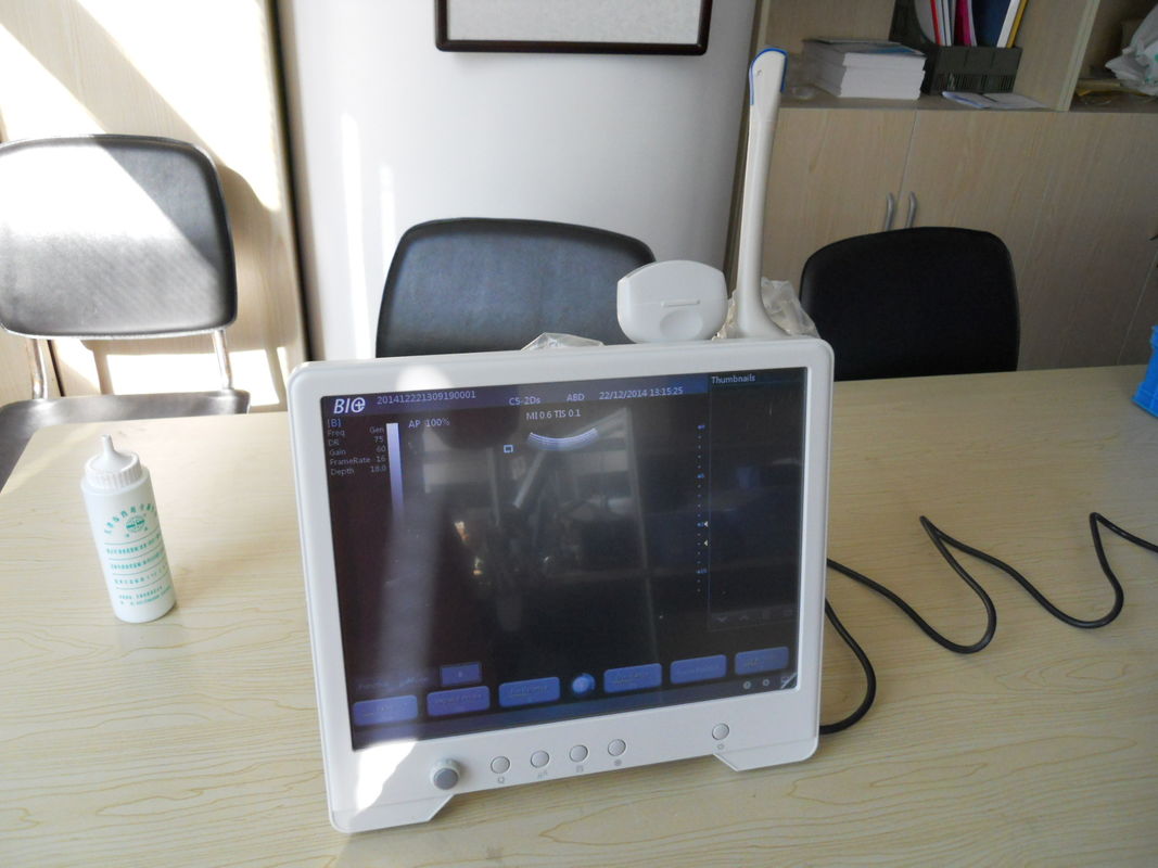 15英寸触摸屏高分辨率便携式超声诊断仪超声诊断设备