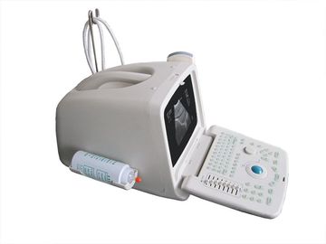 便携式超声波诊断系统超声波扫描仪