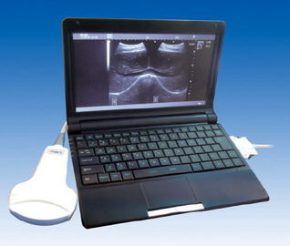 数码超声诊断设备10寸液晶屏外壳可定制的便携式B型超声波诊断仪